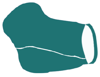 Ellenbogenprotekoren
